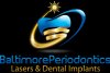 baltimore-periodontics-lasers-dental-implants