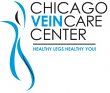 chicago-vein-care-center---varicose-spider-vein-treatment