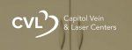 capitol-vein-laser-centers