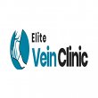 chandler-elite-vein-clinic
