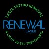 renewal-laser-tattoo-removal