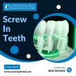 screw-in-teeth