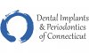 dental-implants-and-periodontics-of-ct