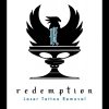 redemption-laser-tattoo-removal